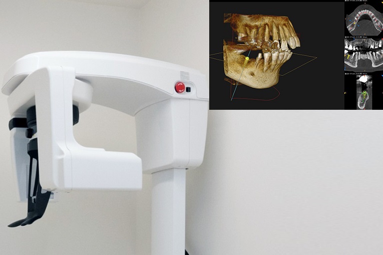 歯科用CT