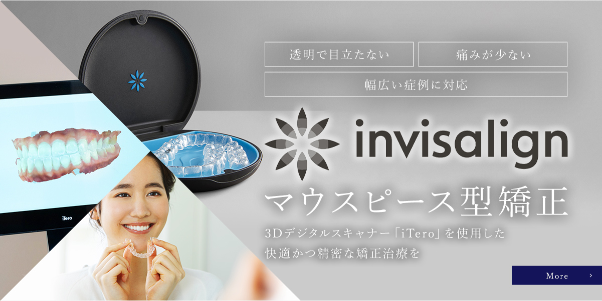 マウスピース型矯正