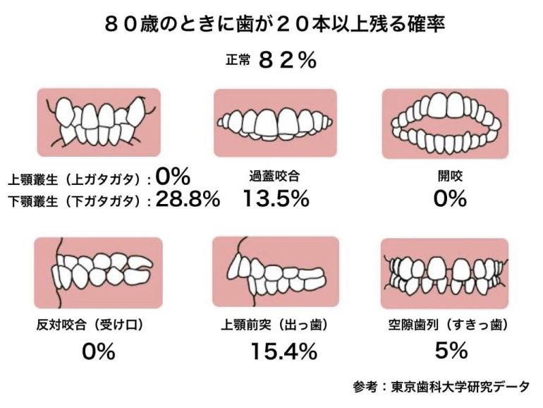 矯正治療が必要な理由